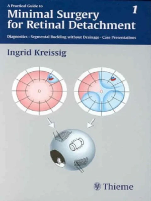 A Practical Guide to Minimal Surgery for Retinal Detachment, Volume 1: Diagnostics, Segmental Buckling Without Drainage, Case Presentations