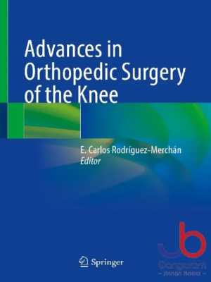 Advances in Orthopedic Surgery of the Knee 1st ed. 2023 Edition