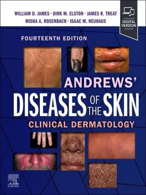 Andrews’ Diseases of the Skin: Clinical Dermatology 14th Edition