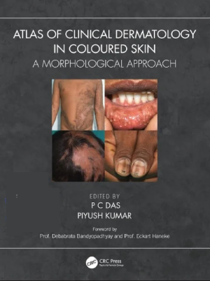 Atlas of Clinical Dermatology in Coloured Skin: A Morphological Approach 1st Edition