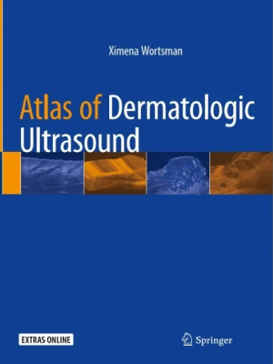 Atlas of Dermatologic Ultrasound 1st ed. 2018 Edition