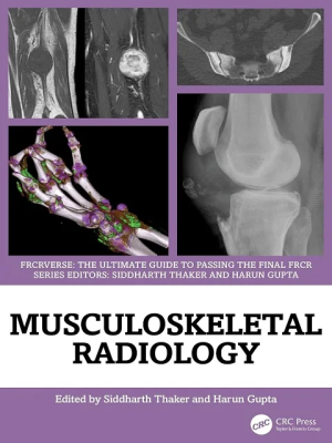 Musculoskeletal Radiology: An Ultimate Guide to Passing the Final FRCR (FRCRverse) 1st Edition