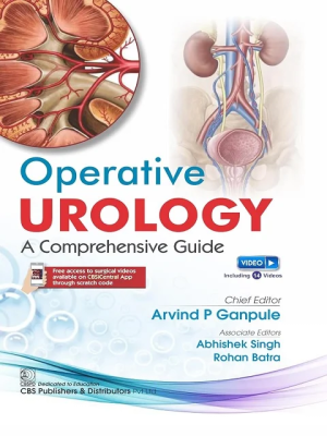 Operative Urology Comprehensive Guide