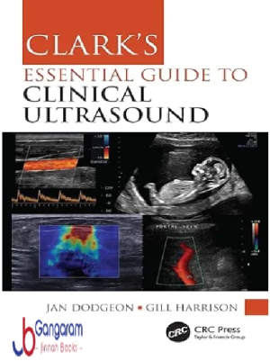 Clark’s Essential Guide to Clinical Ultrasound (Clark’s Companion Essential Guides)