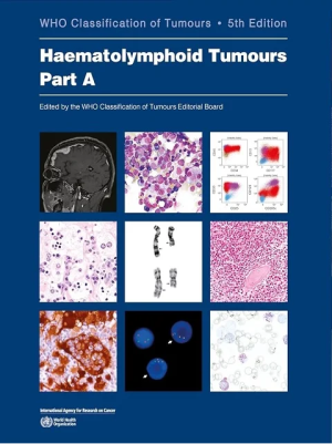 Haematolymphoid Tumours: WHO Classification of Tumours 5th Edition