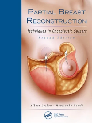 Partial Breast Reconstruction: Techniques in Oncoplastic Surgery 2nd Edition