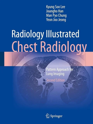 Radiology Illustrated: Chest Radiology: Pattern Approach for Lung Imaging Second Edition
