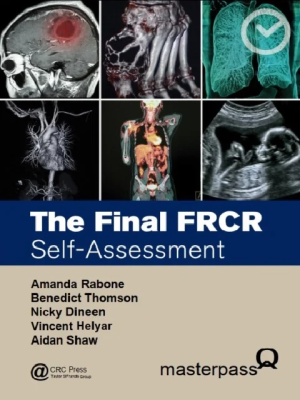 The Final FRCR (MasterPass) 1st Edition