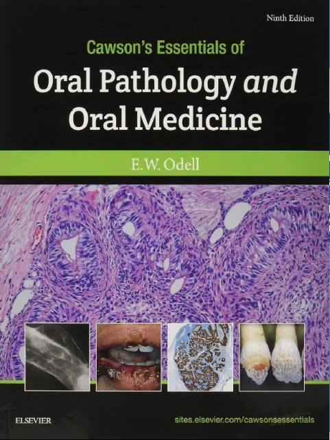 Cawson’s Essentials of Oral Pathology and Oral Medicine 9th Edition