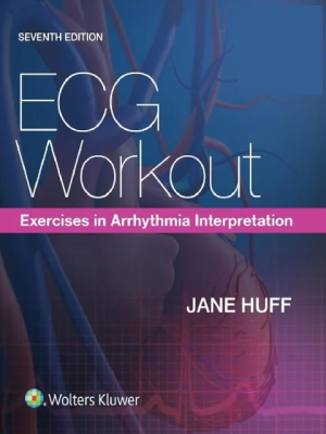 ECG Workout: Exercises in Arrhythmia Interpretation 7th Edition