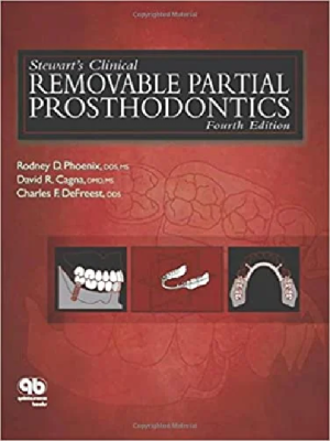 Stewarts Clinical Removable Partial Prosthodontics 4th Ed