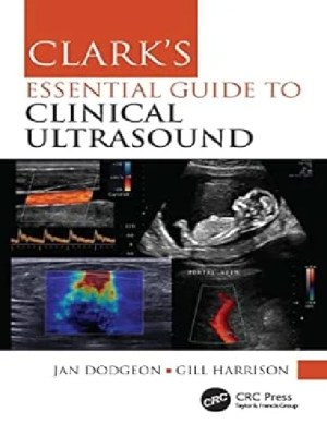 Clark’s Essential Guide to Clinical Ultrasound (Clark’s Companion Essential Guides) 1st Edition