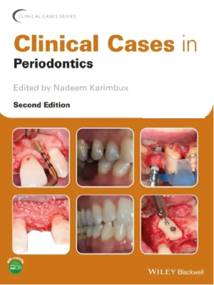Clinical Cases in Periodontics (Clinical Cases (Dentistry)) 2nd Edition