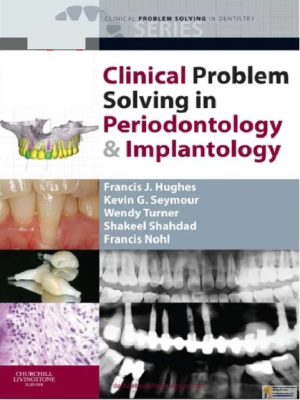 Clinical Problem Solving in Periodontology and Implantology