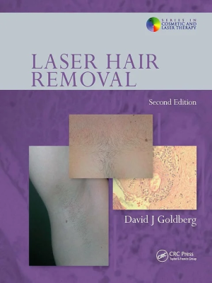 Laser Hair Removal (Series in Cosmetic and Laser Therapy) 2nd Edition