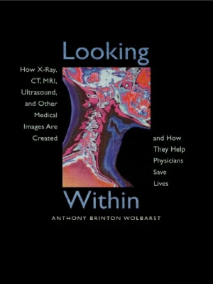 Looking Within: How X-Ray, CT, MRI, Ultrasound, and Other Medical Images Are Created, and How They Help Physicians Save Lives First Edition