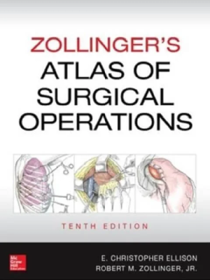 Home Zollinger’s Atlas of Surgical Operations 10th Edition