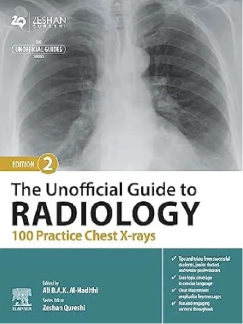 The Unofficial Guide to Radiology: 100 Practice Chest X-rays