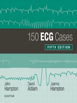 150 ECG Cases 5th Edition
