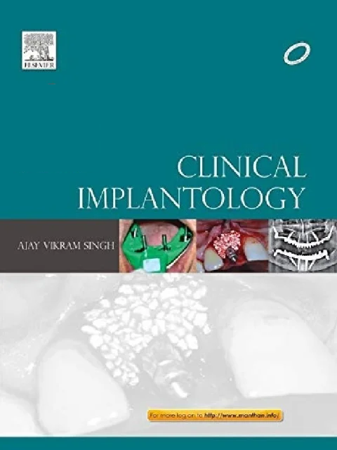 Clinical Implantology 1st Edition