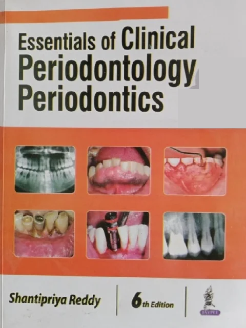 Essentials of Clinical Periodontology & Periodontics 6th Edition