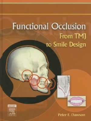 Functional Occlusion From TMJ to Smile Design