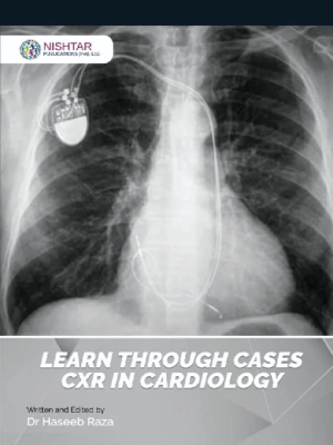 Learn Through Cases CXR Incardiology By Dr Haseeb Raza