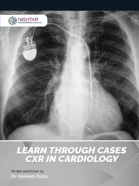Learn Through Cases CXR Incardiology By Dr Haseeb Raza
