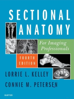 Sectional Anatomy for Imaging Professionals 4th Edition