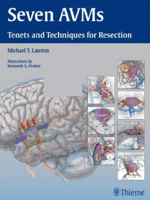 Seven AVMs Tenets and Techniques for Resection Illustrated Edition