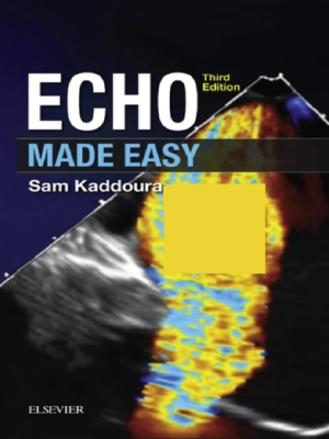 Echo Made Easy 3rd Edition
