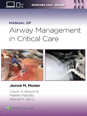Manual of Airway Management in Critical Care 1st Edition Premium Multicolor Matte Print