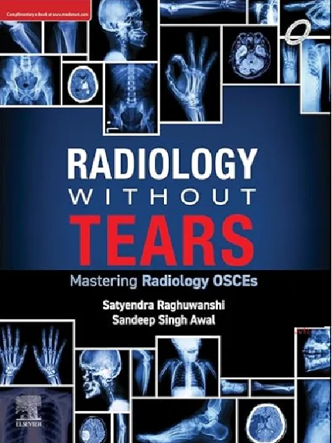 Radiology Without Tears E-Book: Mastering Radiology OSCEs