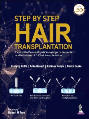 Step by Step Hair Transplantation 1st Edition